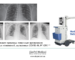 X_ray_ekopel_medical_COVID19_ru